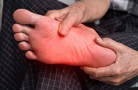 Man suffering from Neuropathy